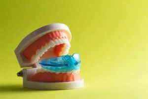 Custom night guard used to protect teeth from grinding during sleep