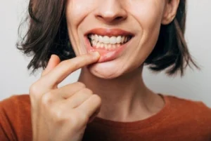 Woman pulling back her lip to show inflamed, receding gums